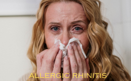 Unraveling the Mysteries of Allergic Rhinitis: Causes, Symptoms, and Effective Management