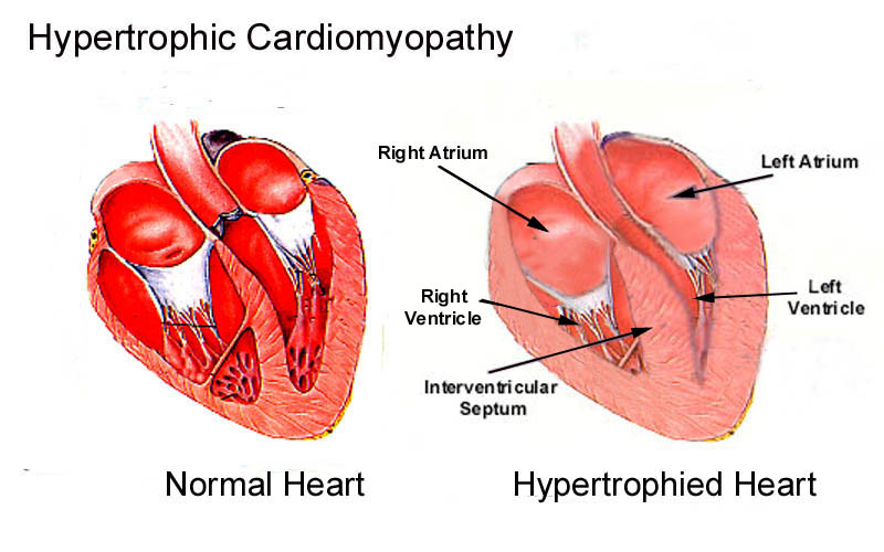 Cardiac Hypertrophy in Animals: