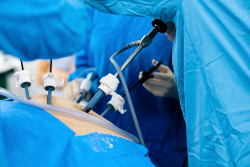 Minimally Invasive Surgery