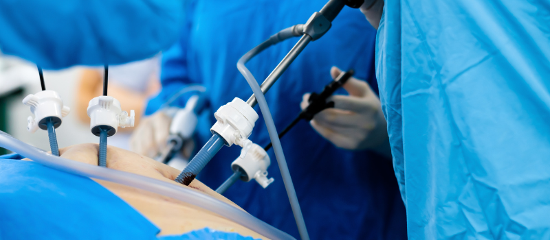 Minimally Invasive Surgery