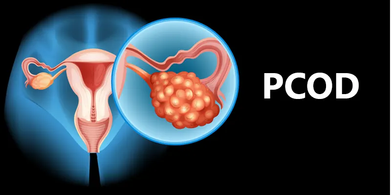 Treatment of PCOD