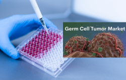 Understanding Germ Cell Tumors: A Complex Journey