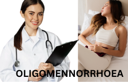 Understanding Oligomenorrhea: Navigating the Challenges of Irregular Menstrual Cycles