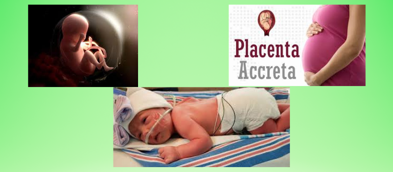 Understanding Placenta Accreta: A Complex Pregnancy Condition