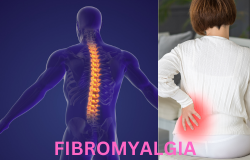  FIBROMYALGIA