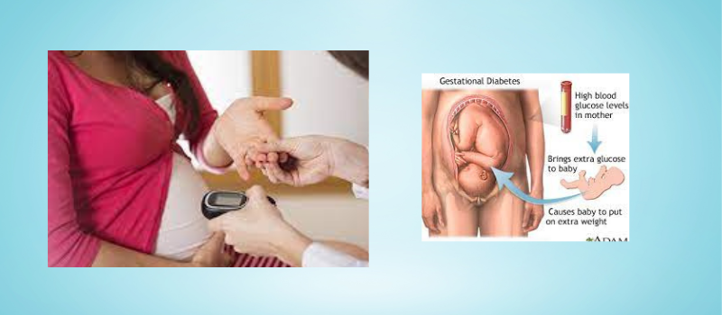  Navigating the Challenges of Pregestational and Gestational Diabetes: A Comprehensive Guide