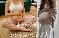  Understanding Ectopic Pregnancy: Symptoms, Risks, and Treatment