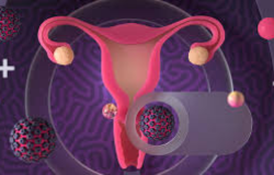  Understanding Cervical Cancer: Prevention, Detection, and Hope