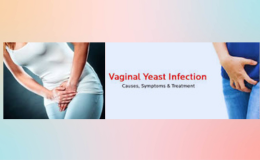 Understanding and Managing Yeast Infections: A Comprehensive Guide to Vaginal Health