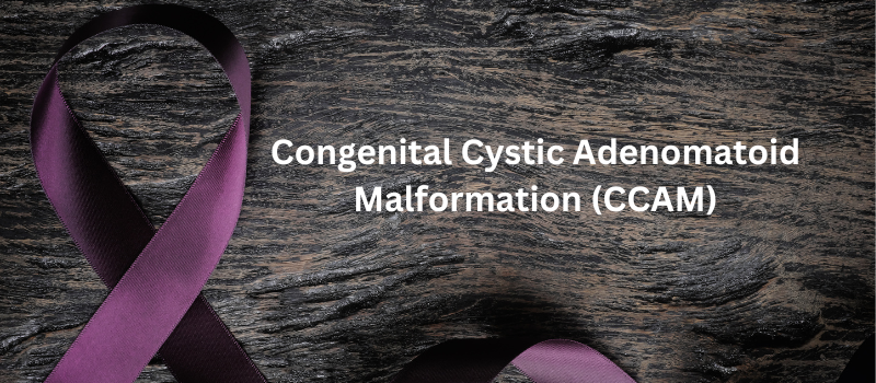  Understanding Congenital Cystic Adenomatoid Malformation (CCAM): A Complex Condition Explained